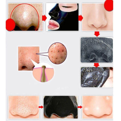 Blackhead Removal Deep Cleaning Face - Niches Store