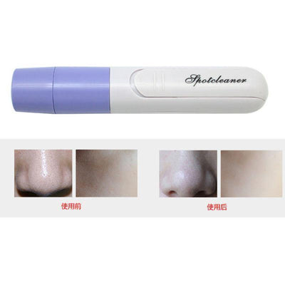 BLACKHEADS VACUUM - Niches Store